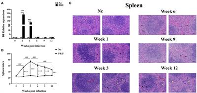 Dynamic Expressions of TIGIT on Splenic T Cells and TIGIT-Mediated Splenic T Cell Dysfunction of Mice With Chronic Toxoplasma gondii Infection